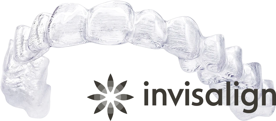 インビザラインを使ったマウスピース矯正